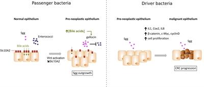 Significance of Streptococcus gallolyticus subsp. gallolyticus Association With Colorectal Cancer